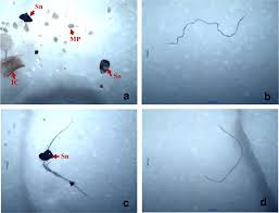 How Microplastics Are Infiltrating the Amazon’s Most Remote Food Webs